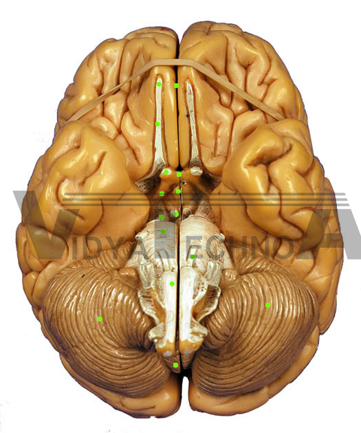 Brain-Inferior View